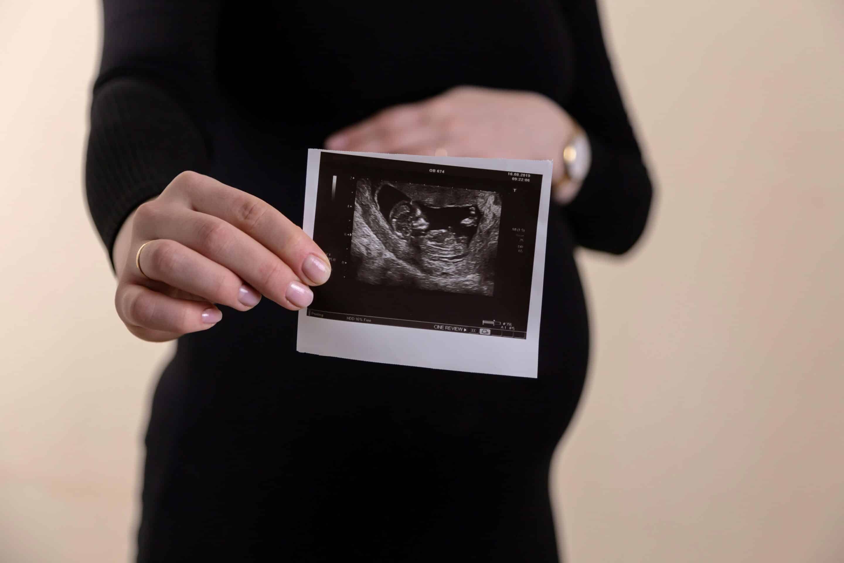 Pregnant woman who used an egg donor holding an ultrasound photo against her belly